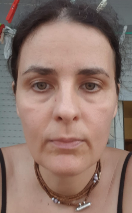 Prije vježbi za lice