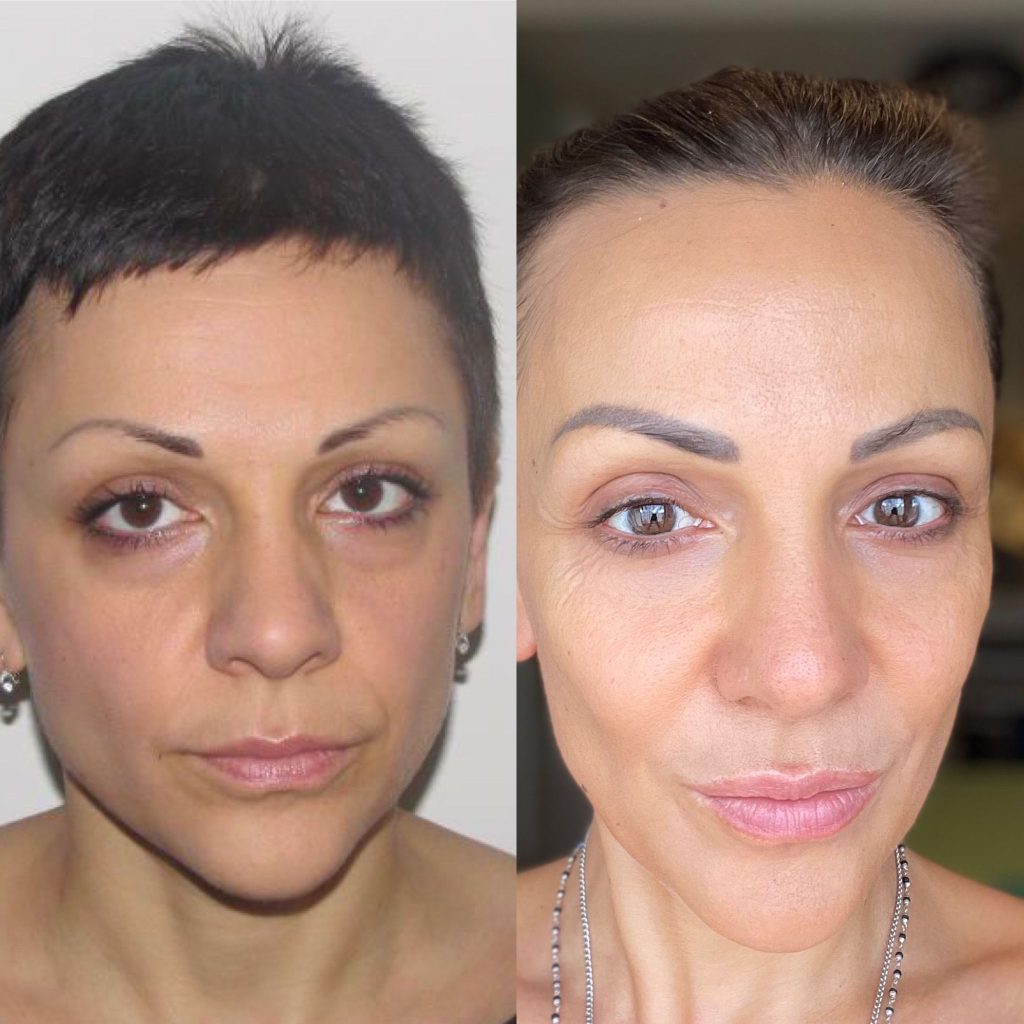 Mia Šoškić - transformacija lica u dobi od 37 i 47 godina